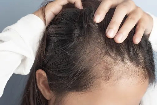 How to increase the volume of your hair